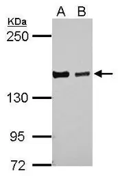 Anti-DZIP3 antibody used in Western Blot (WB). GTX124218