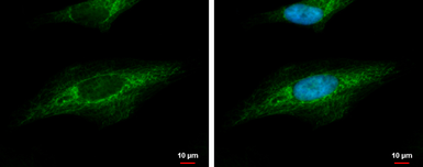 Anti-DAG1 / beta Dystroglycan antibody [C2C3-2], C-term used in Immunocytochemistry/ Immunofluorescence (ICC/IF). GTX124225