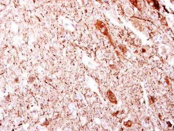 Anti-DAG1 / beta Dystroglycan antibody [C2C3-2], C-term used in IHC (Paraffin sections) (IHC-P). GTX124225