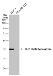 Anti-DAG1 / beta Dystroglycan antibody [C2C3-2], C-term used in Western Blot (WB). GTX124225