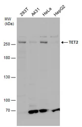 Anti-TET2 antibody used in Western Blot (WB). GTX124227