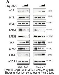 Anti-CTGF antibody used in Western Blot (WB). GTX124232