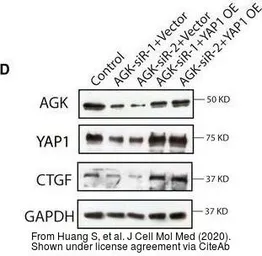 Anti-CTGF antibody used in Western Blot (WB). GTX124232