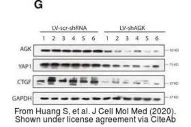 Anti-CTGF antibody used in Western Blot (WB). GTX124232