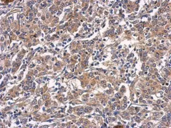 Anti-CTGF antibody used in IHC (Paraffin sections) (IHC-P). GTX124232
