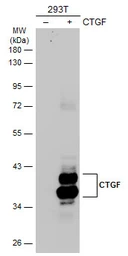 Anti-CTGF antibody used in Western Blot (WB). GTX124232