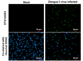 Anti-Dengue virus NS5 protein antibody used in Immunocytochemistry/ Immunofluorescence (ICC/IF). GTX124253