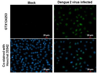 Anti-Dengue virus NS5 protein antibody used in Immunocytochemistry/ Immunofluorescence (ICC/IF). GTX124253