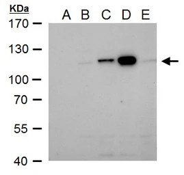 Anti-Dengue virus NS5 protein antibody used in Western Blot (WB). GTX124253