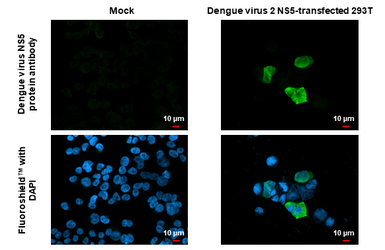 Anti-Dengue virus NS5 protein antibody used in Immunocytochemistry/ Immunofluorescence (ICC/IF). GTX124253