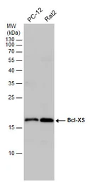 Anti-Bcl-XS antibody used in Western Blot (WB). GTX124266