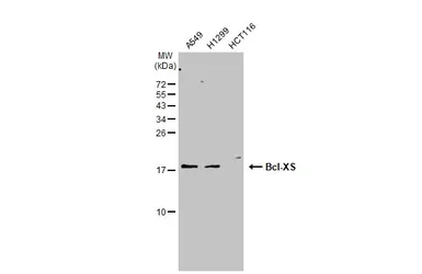 Anti-Bcl-XS antibody used in Western Blot (WB). GTX124266