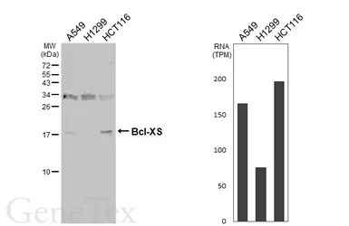Anti-Bcl-XS antibody used in Western Blot (WB). GTX124266