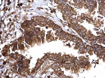 Anti-Bcl-XS antibody used in IHC (Paraffin sections) (IHC-P). GTX124266