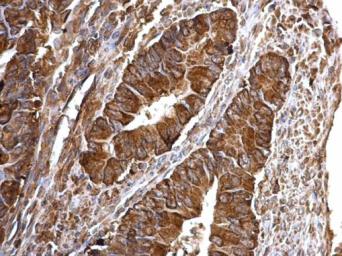 Anti-Bcl-XS antibody used in IHC (Paraffin sections) (IHC-P). GTX124266