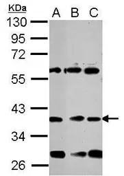 Anti-NeuroD1 antibody used in Western Blot (WB). GTX124268