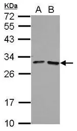 Anti-FOLR4 antibody used in Western Blot (WB). GTX124270