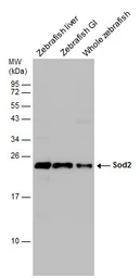 Anti-Sod2 antibody used in Western Blot (WB). GTX124294