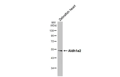 Anti-Aldh1a2 antibody used in Western Blot (WB). GTX124302