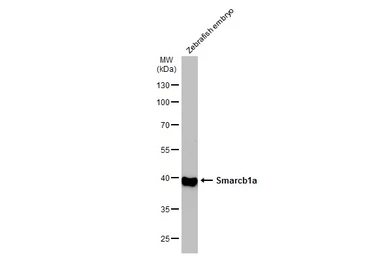 Anti-Smarcb1a antibody used in Western Blot (WB). GTX124337