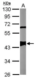 Anti-Smarcb1a antibody used in Western Blot (WB). GTX124337