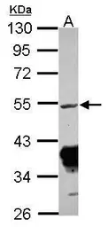 Anti-Rxraa+b antibody used in Western Blot (WB). GTX124342