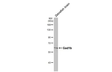 Anti-Gad1b antibody used in Western Blot (WB). GTX124355
