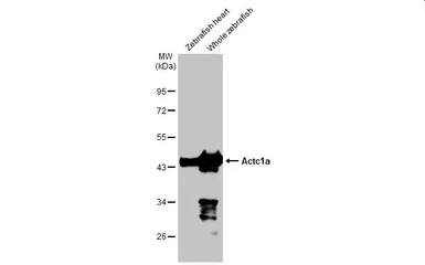 Anti-Actc1a antibody used in Western Blot (WB). GTX124462