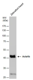 Anti-Acta1b antibody used in Western Blot (WB). GTX124484