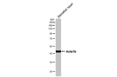 Anti-Acta1b antibody used in Western Blot (WB). GTX124484