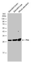 Anti-Phb antibody used in Western Blot (WB). GTX124491
