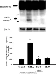 Anti-Bactin1 antibody used in Western Blot (WB). GTX124500