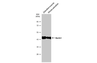 Anti-Bactin1 antibody used in Western Blot (WB). GTX124501