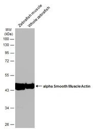 Anti-Acta2 antibody used in Western Blot (WB). GTX124505