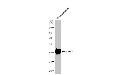 Anti-Acta2 antibody used in Western Blot (WB). GTX124505