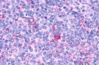 Anti-GPCR G2A antibody used in IHC (Paraffin sections) (IHC-P). GTX12530