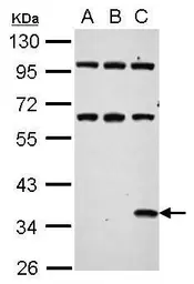 Anti-Renilla Luciferase antibody used in Western Blot (WB). GTX125852