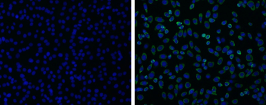 Anti-Japanese encephalitis virus NS1 antibody used in Immunocytochemistry/ Immunofluorescence (ICC/IF). GTX125866