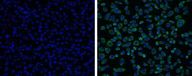 Anti-Japanese encephalitis virus NS3 antibody used in Immunocytochemistry/ Immunofluorescence (ICC/IF). GTX125868