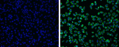 Anti-Japanese encephalitis virus NS3 antibody used in Immunocytochemistry/ Immunofluorescence (ICC/IF). GTX125868