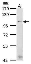 Anti-Thbs4b antibody used in Western Blot (WB). GTX125870