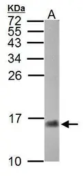 Anti-Crabp2a antibody used in Western Blot (WB). GTX125882