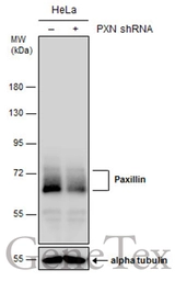 Anti-Paxillin antibody used in Western Blot (WB). GTX125891