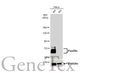 Anti-Paxillin antibody used in Western Blot (WB). GTX125891