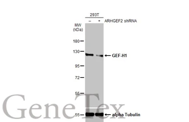Anti-GEF-H1 antibody used in Western Blot (WB). GTX125893