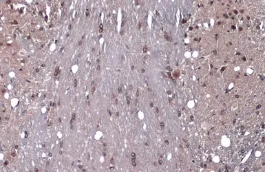 Anti-GEF-H1 antibody used in IHC (Paraffin sections) (IHC-P). GTX125893