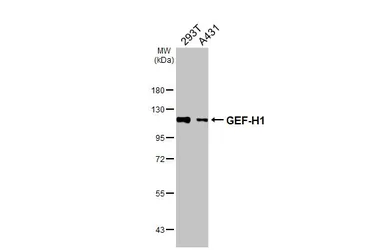 Anti-GEF-H1 antibody used in Western Blot (WB). GTX125893