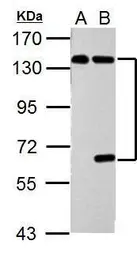 Anti-USP7 antibody used in Western Blot (WB). GTX125894