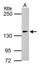 Anti-USP7 antibody used in Western Blot (WB). GTX125894