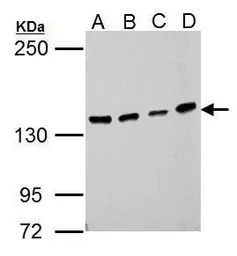 Anti-USP7 antibody used in Western Blot (WB). GTX125894